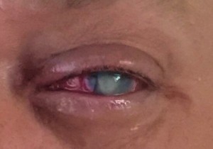 φακούς επαφής 4