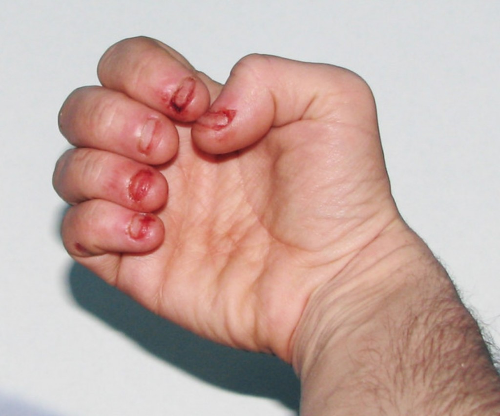 66fcaf4ce9263c5c90965fb3d11ece9f