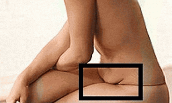 25901262223_72e395d637_o