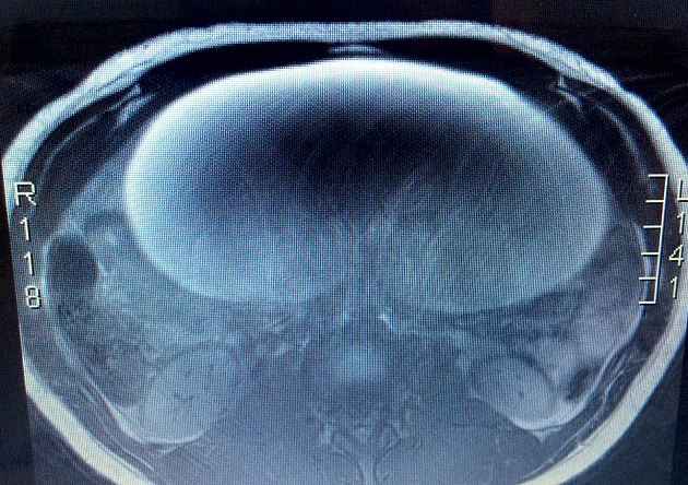 26034047660_df1fd717db_o