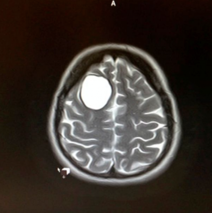 26105417983_1df663ef13_o