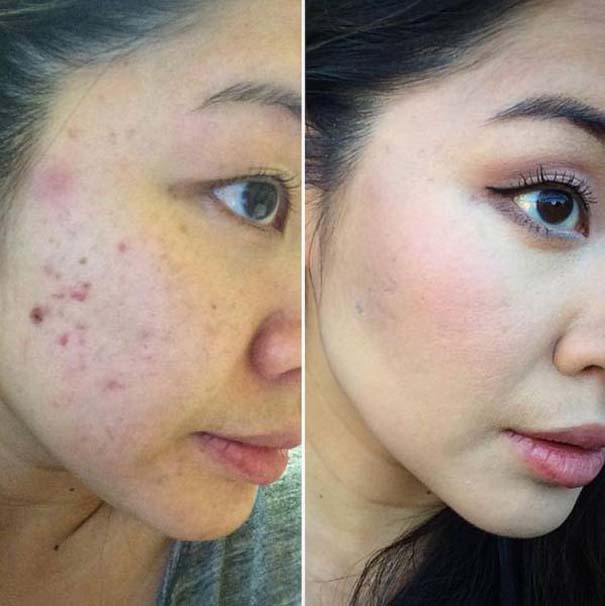 b715786444578ce25735e5aecdf45464