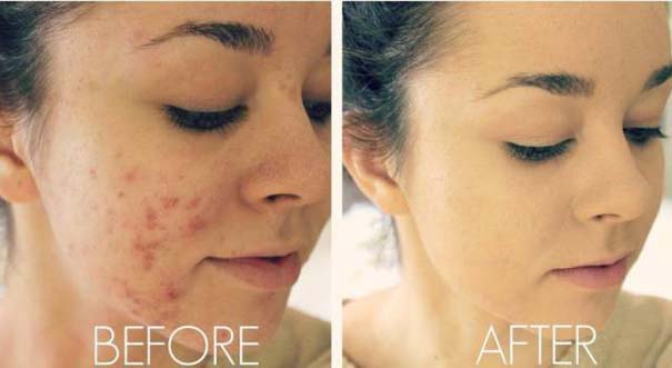 e9d85de0ea08c881c31cfb26abd6f847