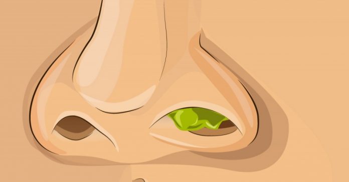 ZF58IXV7RsAChNySltcrHWkXxrYRYh2YW77F42MW