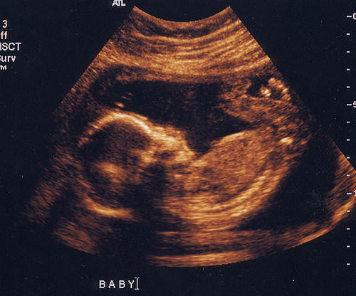 62c9383b48bc69f433c81b81b9bacab2