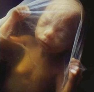 dd53307403a8bea87fb585c8abab621e